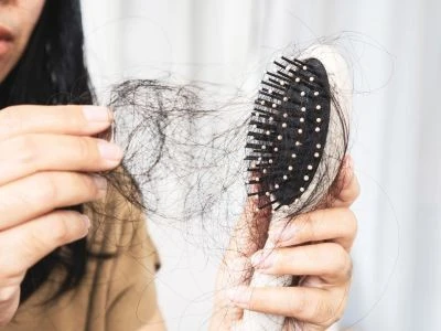 Hair Loss
